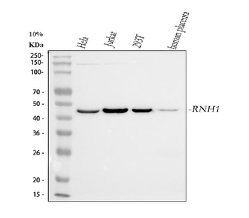 Anti-Ribonuclease Inhibitor/RNH1 Antibody (monoclonal, 4F3)