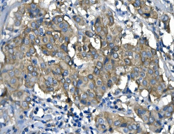 Anti-RENT1/hUPF1 Antibody (monoclonal, 11E7)