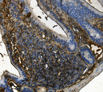 Anti-RENT1/hUPF1 Antibody (monoclonal, 11E7)