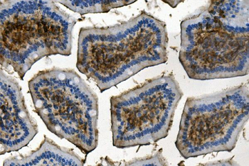 Anti-RENT1/hUPF1 Antibody (monoclonal, 11E7)