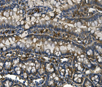 Anti-RENT1/hUPF1 Antibody (monoclonal, 11E7)