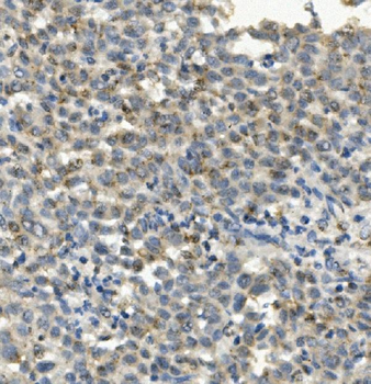 Anti-CCR2 Antibody (monoclonal, 8C4)