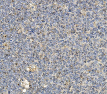 Anti-CCR2 Antibody (monoclonal, 8C4)
