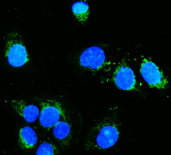 Anti-Hexokinase 1/HK1 Antibody (monoclonal, 2I4)