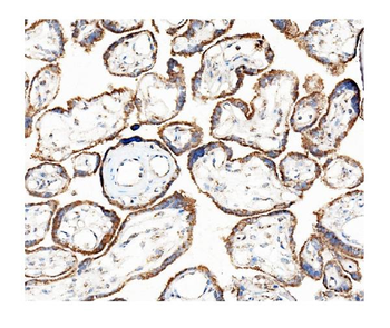Anti-Hexokinase 1/HK1 Antibody (monoclonal, 2I4)