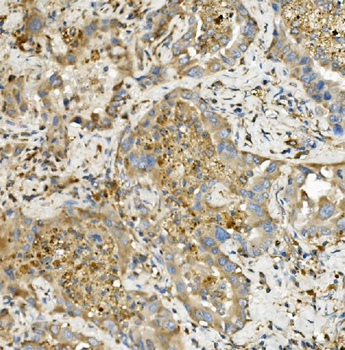 Anti-Hexokinase 1/HK1 Antibody (monoclonal, 2I4)