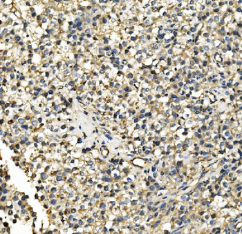 Anti-Hexokinase 1/HK1 Antibody (monoclonal, 2I4)