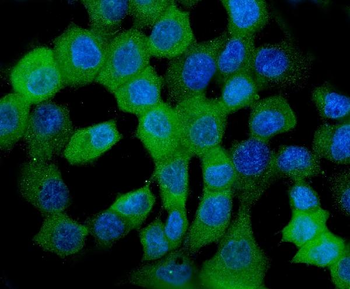 Anti-HSPB8/Hsp22 Antibody (monoclonal, 7D8)