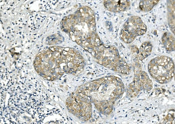Anti-BubR1/BUB1B Antibody (monoclonal, 5I7)