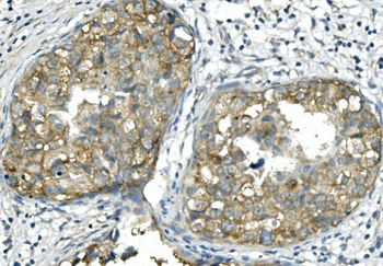 Anti-BubR1/BUB1B Antibody (monoclonal, 5I7)