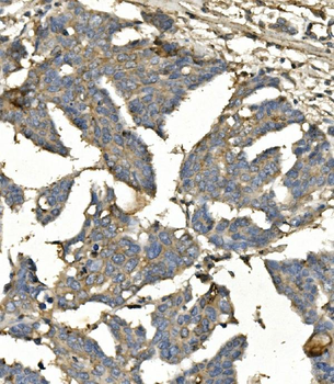 Anti-BubR1/BUB1B Antibody (monoclonal, 5I7)