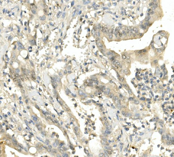 Anti-BubR1/BUB1B Antibody (monoclonal, 5I7)