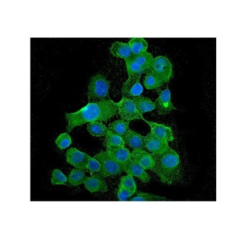 BubR1/BUB1B Antibody (monoclonal, 5I7)