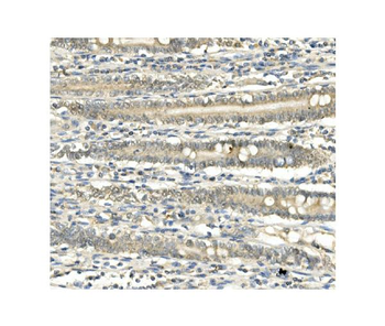 Anti-BubR1/BUB1B Antibody (monoclonal, 8B3)