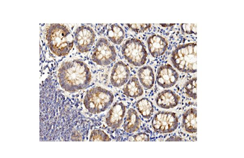 Anti-BubR1/BUB1B Antibody (monoclonal, 8B3)