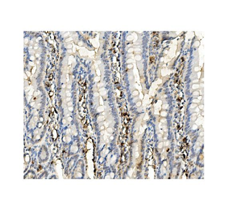Anti-BubR1/BUB1B Antibody (monoclonal, 8B3)