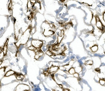 CD31/PECAM1 Antibody (monoclonal, 2D4)