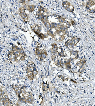 Anti-alpha 1 Catenin/CTNNA1 Antibody (monoclonal, 10I2)