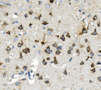 Anti-Thioredoxin 2/TXN2 Antibody (monoclonal, 4H3)
