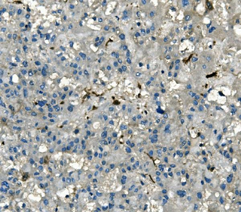 Anti-AKR1D1 Antibody (monoclonal, 6I4)