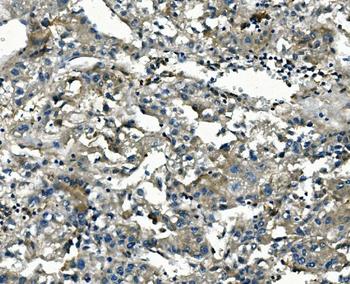 Anti-AKR1D1 Antibody (monoclonal, 6I4)
