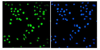 Anti-SMARCA2/BRM Antibody (monoclonal, 3G3)
