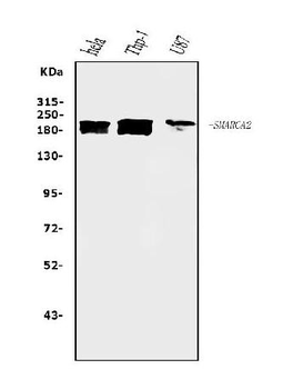 Anti-SMARCA2/BRM Antibody (monoclonal, 3G3)