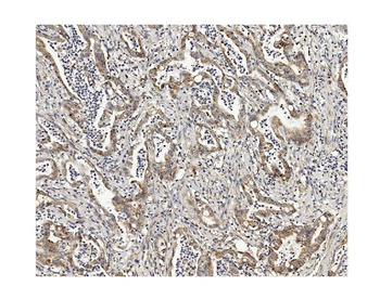 Anti-Methylmalonyl Coenzyme A mutase Antibody (monoclonal, 2D6)