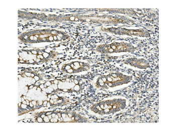 Anti-Methylmalonyl Coenzyme A mutase Antibody (monoclonal, 2D6)