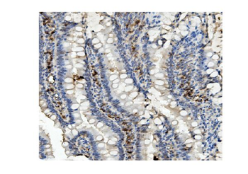 Anti-Methylmalonyl Coenzyme A mutase Antibody (monoclonal, 2D6)