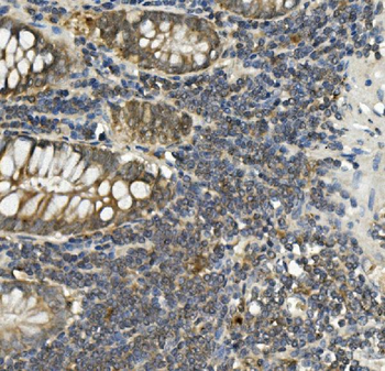 Anti-Bid Antibody (monoclonal, 10F4)
