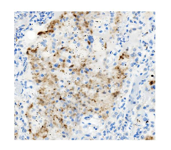 Anti-ATG4A Antibody