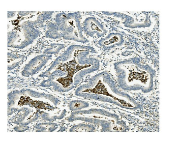 Anti-ATG4A Antibody