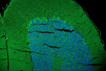 Anti-GAP43 Antibody