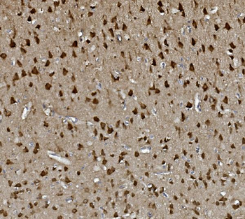 Anti-GAP43 Antibody