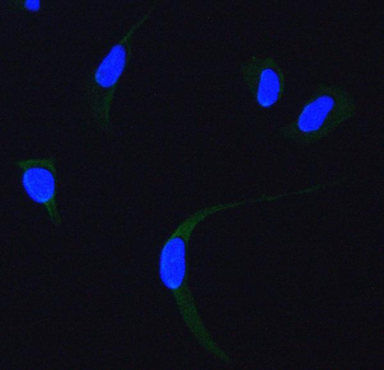 Anti-SDHA Antibody