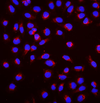 Anti-SGK1 Antibody