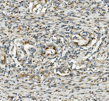 Anti-SGK1 Antibody