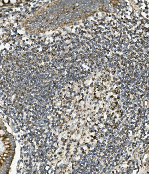 Anti-SGK1 Antibody