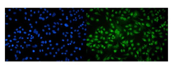 Anti-Aryl hydrocarbon Receptor/AHR Antibody