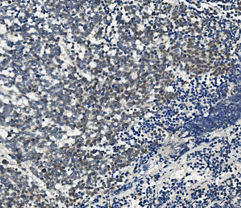 Anti-Aryl hydrocarbon Receptor/AHR Antibody