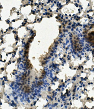 Anti-Aryl hydrocarbon Receptor/AHR Antibody
