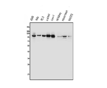 Anti-Aryl hydrocarbon Receptor/AHR Antibody