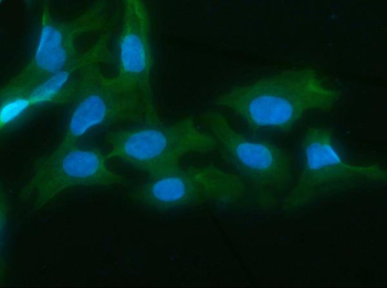 Anti-AKR1D1 Antibody