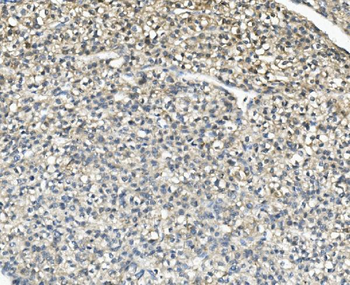 Anti-AKR1D1 Antibody