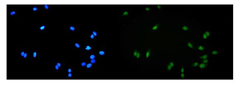 Anti-ALKBH1 Antibody