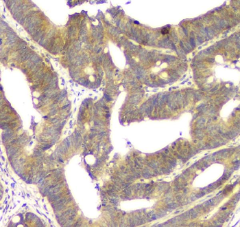 Anti-ALKBH1 Antibody