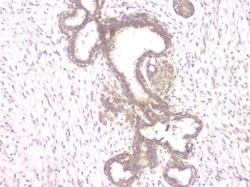 Anti-ALKBH1 Antibody