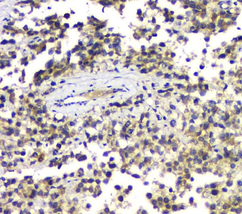 Anti-ALKBH1 Antibody