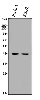 Anti-ALKBH1 Antibody